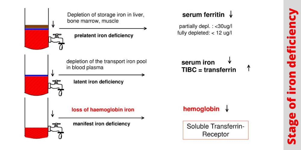 Stage of iron deficiency