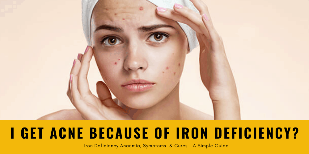 i get acne because of iron deficiency